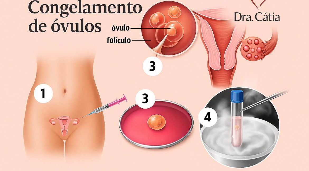 Congelamento de óvulos