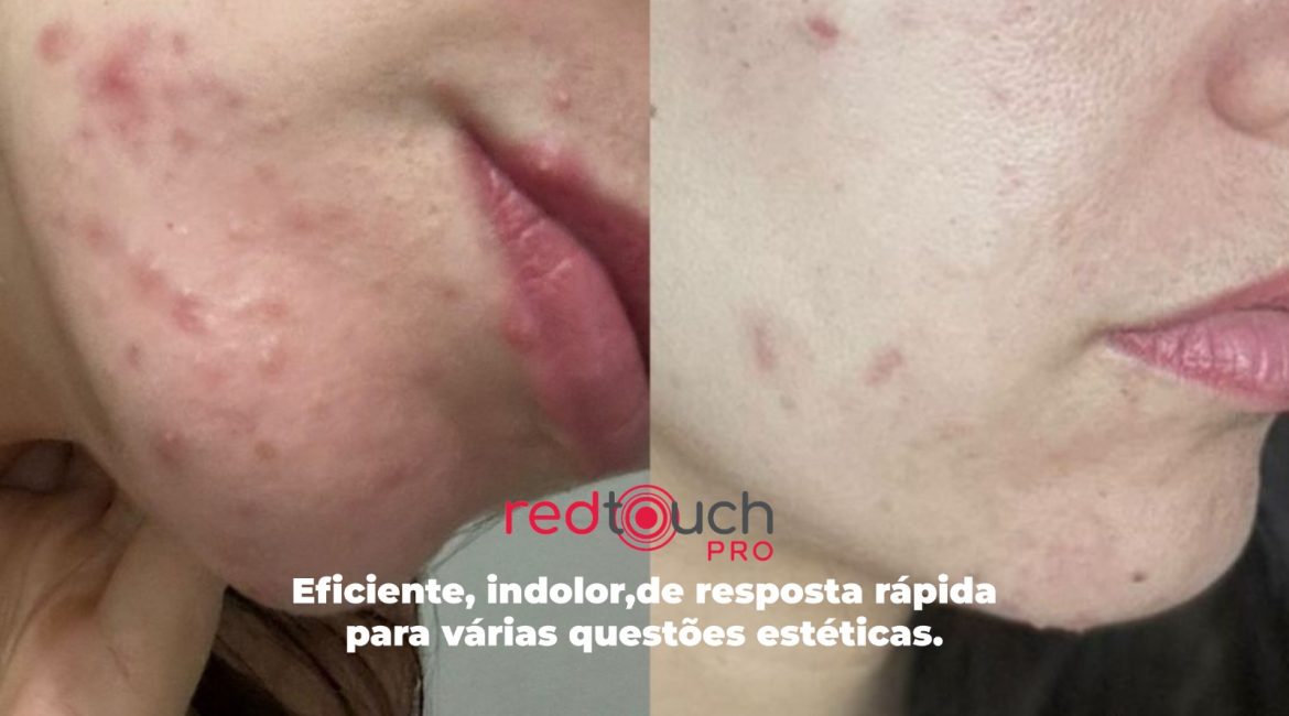 Red Touch